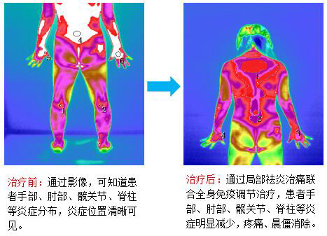 治疗前后.jpg