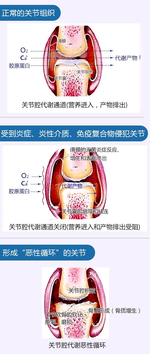 关节组织.jpg