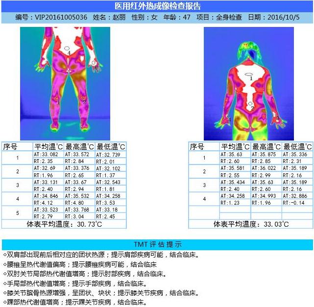 [CropImg]红外热评估图.jpg